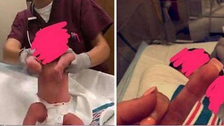 Pielęgniarki wykorzystały noworodki do zdjęć w skandaliczny sposób! Pochwaliły się w sieci!