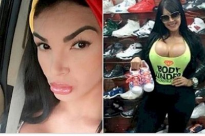 Przeszła ponad 20 operacji plastycznych, żeby osiągnąć wygląd idealny! Nie da się jej poznać na starych fotografiach! 