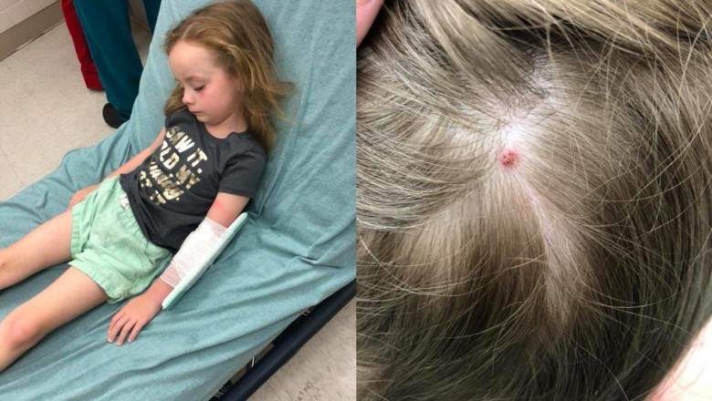 Zdrowa 5-latka nagle doznaje całkowitego paraliżu ciała! Przeczesując jej włosy znajduje coś nietypowego! 