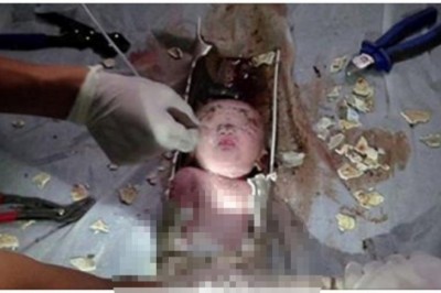 Ukrywała swoją ciążę i noworodka próbowała spuścić w toalecie! Zobacz niezwykłą akcje ratunkową!