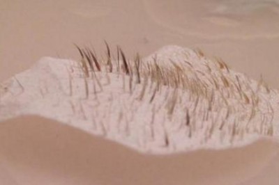 Nie powiesz tego nikomu ale obejrzysz to z przyjemnością! Zdjęcia plastrów na wągry tuż po użyciu! 