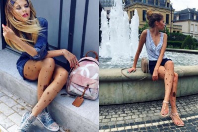 W dzieciństwie była wyśmiewana i nazywana „dalmatyńczykiem”! Jej znamiona na skórze czynią ją wyjątkową! 