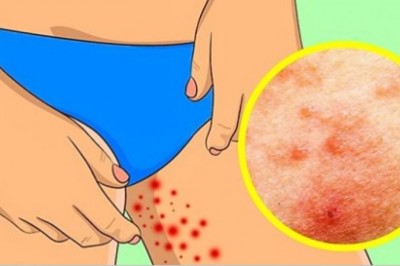 Zobacz jak pozbyć się problemów, z którymi większość z nas zmaga się podczas lata! Przetrwaj upały! 