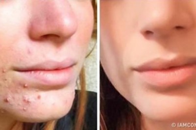 5 skutecznych porad, które pomogą ci w pielęgnacji skóry! Zobacz jak uzyskać gładką cerę w domu!