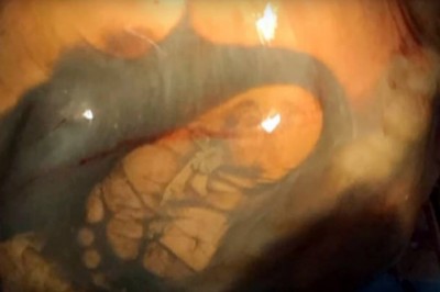 W 41 tygodniu ciąży przychodzi na USG. To, co lekarz odkrywa podczas badań odbiera wszystkim mowę