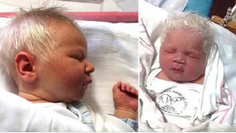 Ten chłopiec urodził się całkowicie siwymi włosami. Nawet lekarze byli zaskoczeni tym widokiem 