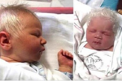 Ten chłopiec urodził się całkowicie siwymi włosami. Nawet lekarze byli zaskoczeni tym widokiem