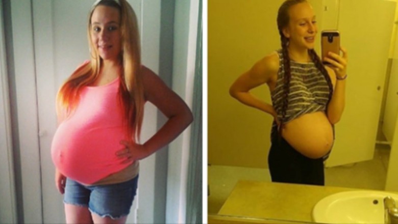 Nieletnie dziewczyny chwalą się na Instagramie ciążowymi brzuszkami. Niestety jest ich coraz więcej 