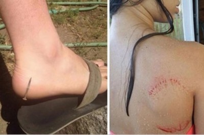 19 sytuacji w których ludzie cudem uniknęli nieszczęścia. Było dosłownie o włos od tragedii