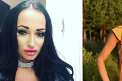 Ciężko uwierzyć jak wyglądała przed operacjami. Małgosia Godlewska 6 lat temu była blondynką