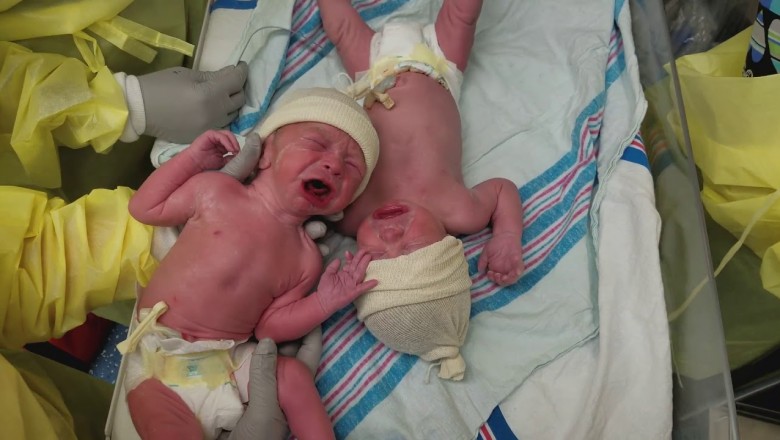 Po urodzeniu te bliźniaki nie przestawały płakać. Wystarczył jeden gest położnej by je uspokoić
