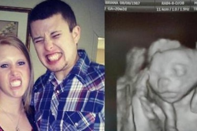 Zdecydowała się na terapię hormonalną, żeby zajść w ciążę. Podczas USG lekarz widzi coś zaskakującego