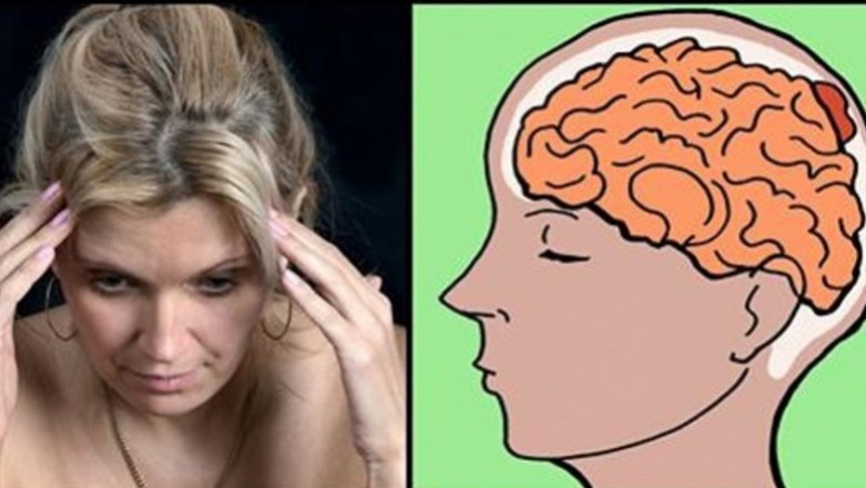 Poznaj 5 objawów świadczących, że możesz mieć guza mózgu. Wcześnie wykryty da się leczyć