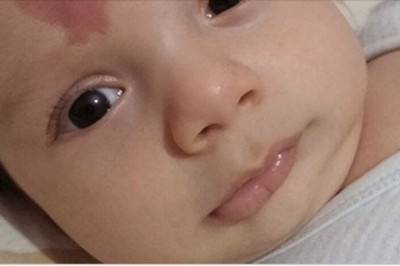 Jak położna zobaczyła znamię z jakim się urodził zaniemówiła. Rodzice nie mogli powstrzymać łez