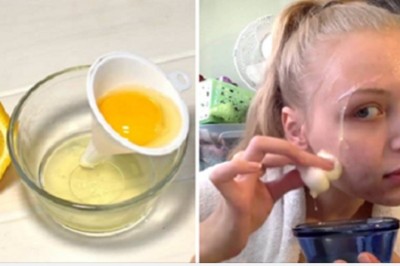 Ta maseczka do twarzy z jajek i cytryny napina skórę niemal jak botoks. Wystarczy regularne stosowanie 