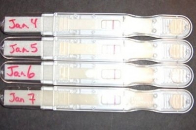 Kobieta robi siedem testów ciążowych, ale wciąż coś jest źle. Dopiero wtedy lekarze odkrywają prawdę