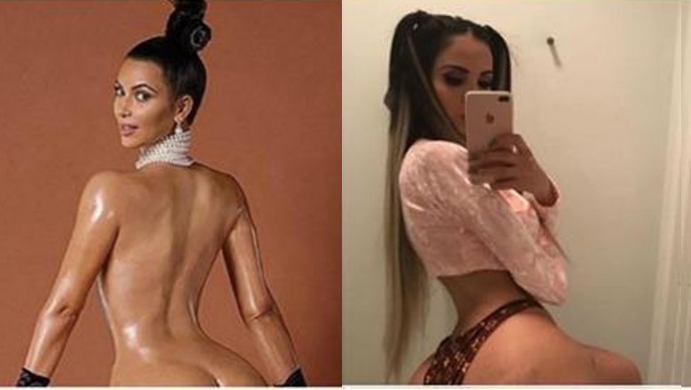 Ta kobieta wstrzyknęła w pośladki 2 litry tłuszczu, żeby mieć pupę jak Kim Kardashian. Rachunek 240 tys