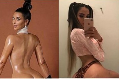 Ta kobieta wstrzyknęła w pośladki 2 litry tłuszczu, żeby mieć pupę jak Kim Kardashian. Rachunek 240 tys