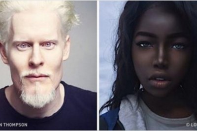 Poznaj osoby, których unikalny kolor skóry podbił świat! Ich uroda oczarowała tysiące ludzi!