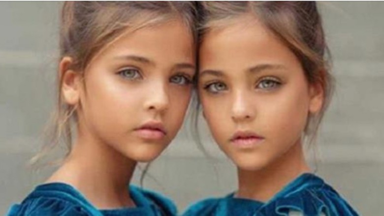 „Najpiękniejsze bliźniaczki na świecie” rozpoczęły karierę modelek. Ich zdjęcia robią wrażenie 