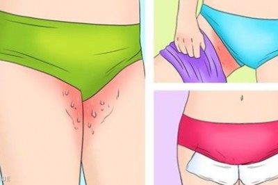 5 domowych sposobów na grzybicę skóry, które naprawdę działają. Warto skorzystać z naturalnych metod