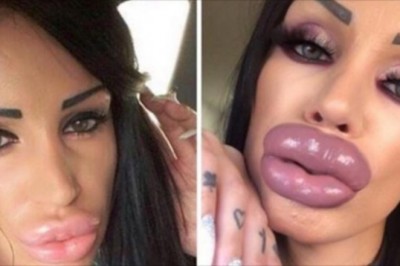 Przykłady operacji plastycznych które zrobiły więcej złego niż dobrego. Takie rzeczy trzeba z głową