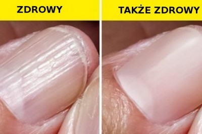 10 niepokojących symptomów często branych za początek choroby, które są zwykle nieszkodliwe