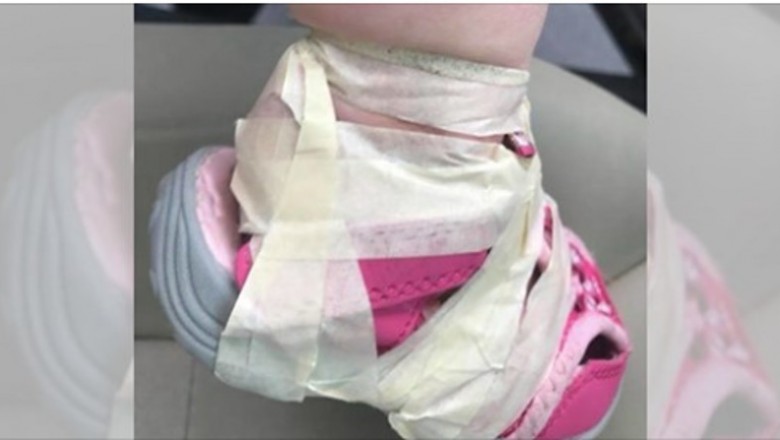Przedszkolanki przykleiły taśmą buciki do stóp jej córki. Półtoraroczna dziewczynka miała siniaki