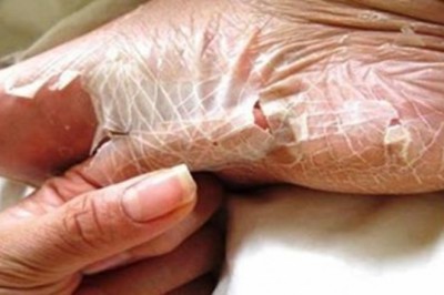 8 niezwykłych rzeczy jakie potrafi zrobić Twoje ciało. O większości z nich ludzie nie mają pojęcia