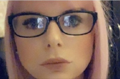 Powiększyła usta u „domowej kosmetyczki”. Jej wargi powiększyły się 10-krotnie