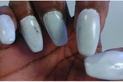 10 najgorszych przykładów pracy manikiurzystek. Widząc swoje paznokcie były załamane