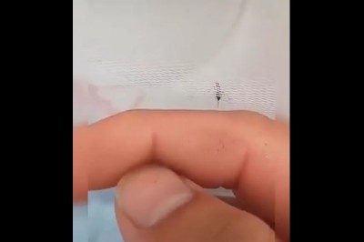 Wkurzanie głodnego komara. To dopiero dziwna zabawa