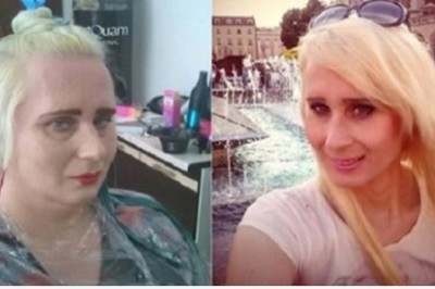 Alex z Chłopaków do Wzięcia  znów poprawiała swój wygląd. Odwiedziła salon medycyny estetycznej 