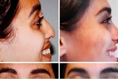 14 osób, które włożyły dużo wysiłku by zmienić się nie do poznania