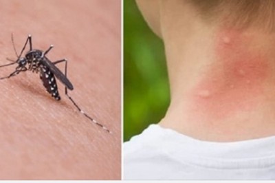 Komary gryzą Cię częściej niż innych? Biologia wyjaśnia czemu tak się dzieje