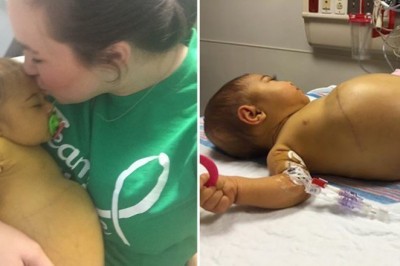 Jej brzuch od urodzenia nie przestaje rosnąć. Lekarze zrozumieli wpadli w panikę