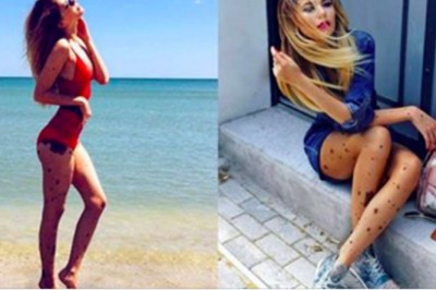 W dzieciństwie nazywali ją „dalmatyńczykiem”. Dziś jej oryginalna uroda to atut 