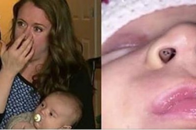 Karmiła piersią dziecko i zobaczyła w jego nosie czarne punkciki. Po chwili połączyła fakty