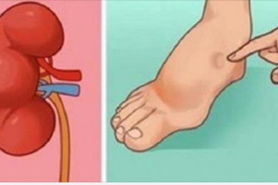 Twoje ciało ostrzega Cię na 24 godziny przed udarem. Zwróć uwagę na te objawy