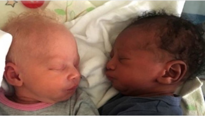W łódzkim szpitalu urodziły się bliźniaki o różnym kolorze skóry. „To prawdziwa rzadkość”