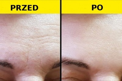 6 prostych codziennych sposobów na schudnięcie i odmłodzenie wyglądu