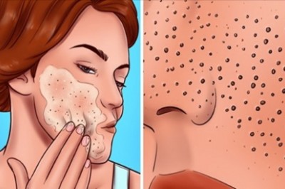 8 błędów popełnianych podczas pielęgnacji skóry, które sprawiają, że pory wyglądają na większe