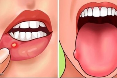 7 objawów świadczących o tym, że twój organizm ma braki kwasu foliowego. Zobacz jak je uzupełnić