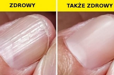 10 symptomów często branych za początek choroby, które są zwykle nieszkodliwe