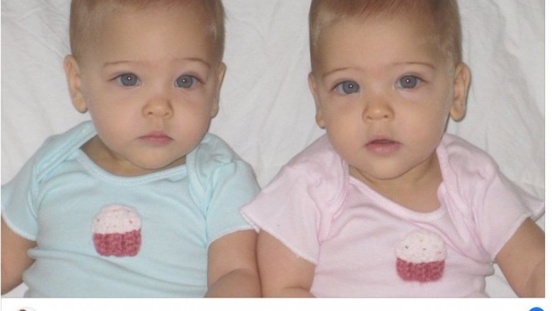 Urodziły się 10 lat temu. Dziś są uznawane za najpiękniejsze bliźniaczki w historii 