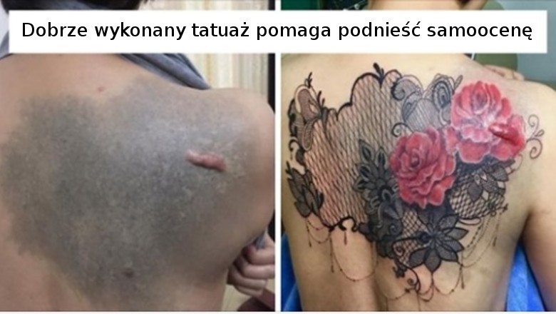 18 osób, które zdecydowały się ukryć swoje niedoskonałości za pięknymi tatuażami