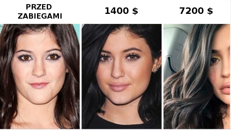 Ile kosztuje „twarz instagramowej modelki”, i przeprowadzenia jakich operacji wymaga