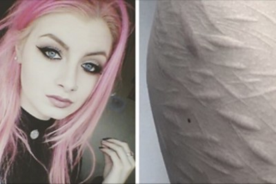 Żaden tatuażysta nie chciał zakryć blizn na ciele tej 19-latki. Jeden się odważył