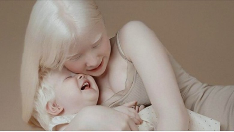Siostry-albinoski urodzone w odstępie 12 lat oczarowały internet swoimi fotografiami