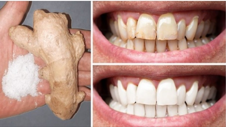 8 naturalnych sposobów na domowe wybielenie zębów  i poprawę uśmiechu 